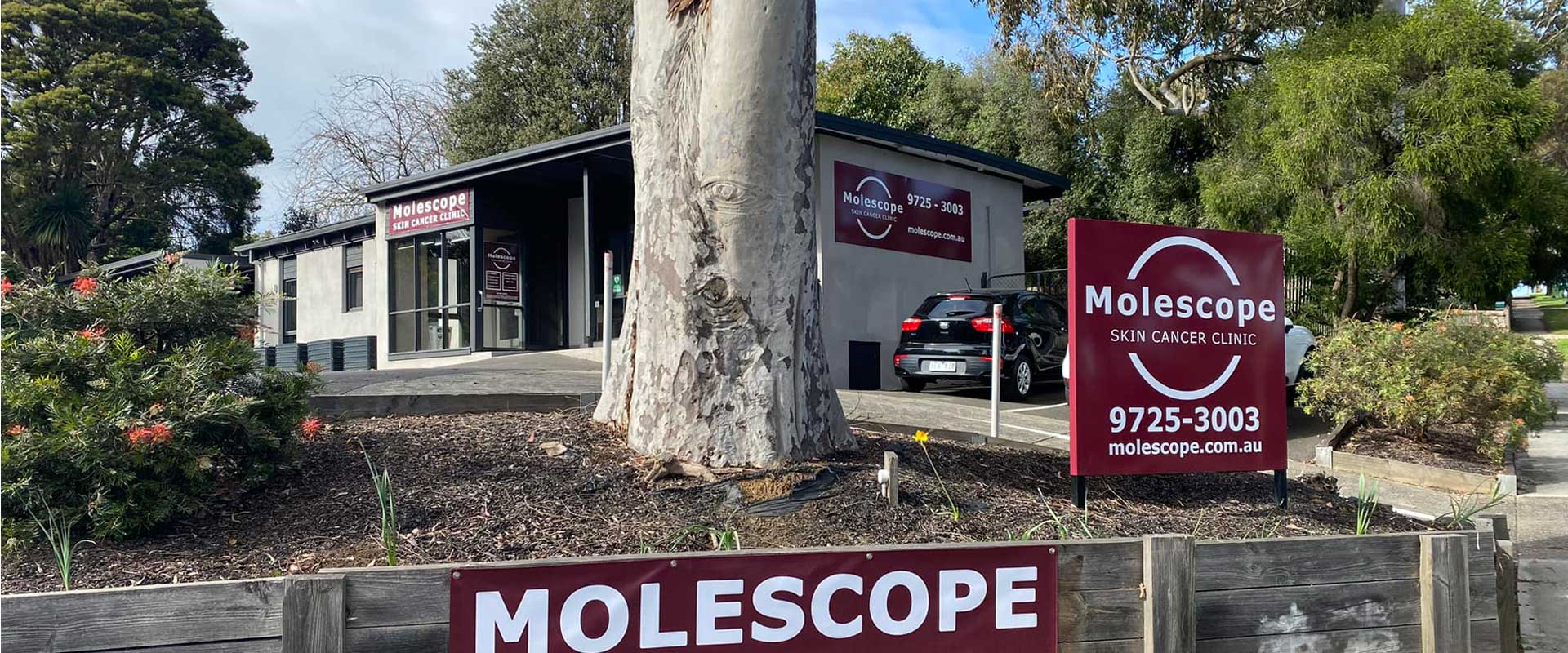 Molescope Skin Cancer Clinic