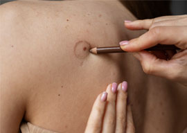 Photo for spot checks. Looking at individual moles or spots