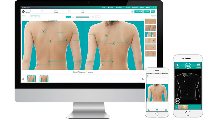 A graphic showing computers and phones with the Dermengine software