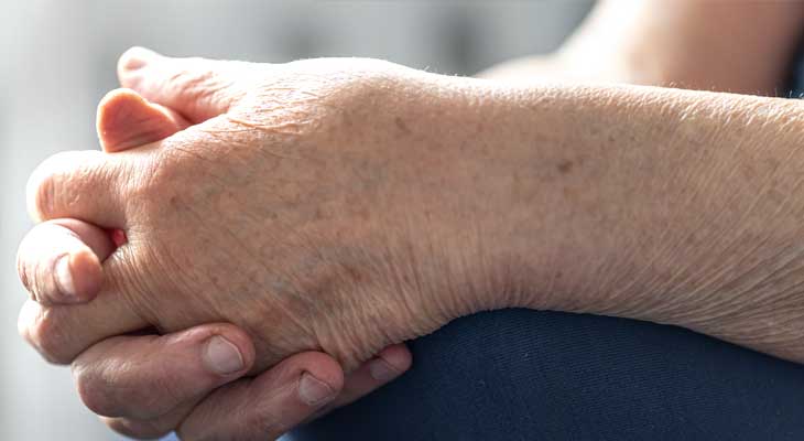Hands of an elderly woman showing how skin ages over time
