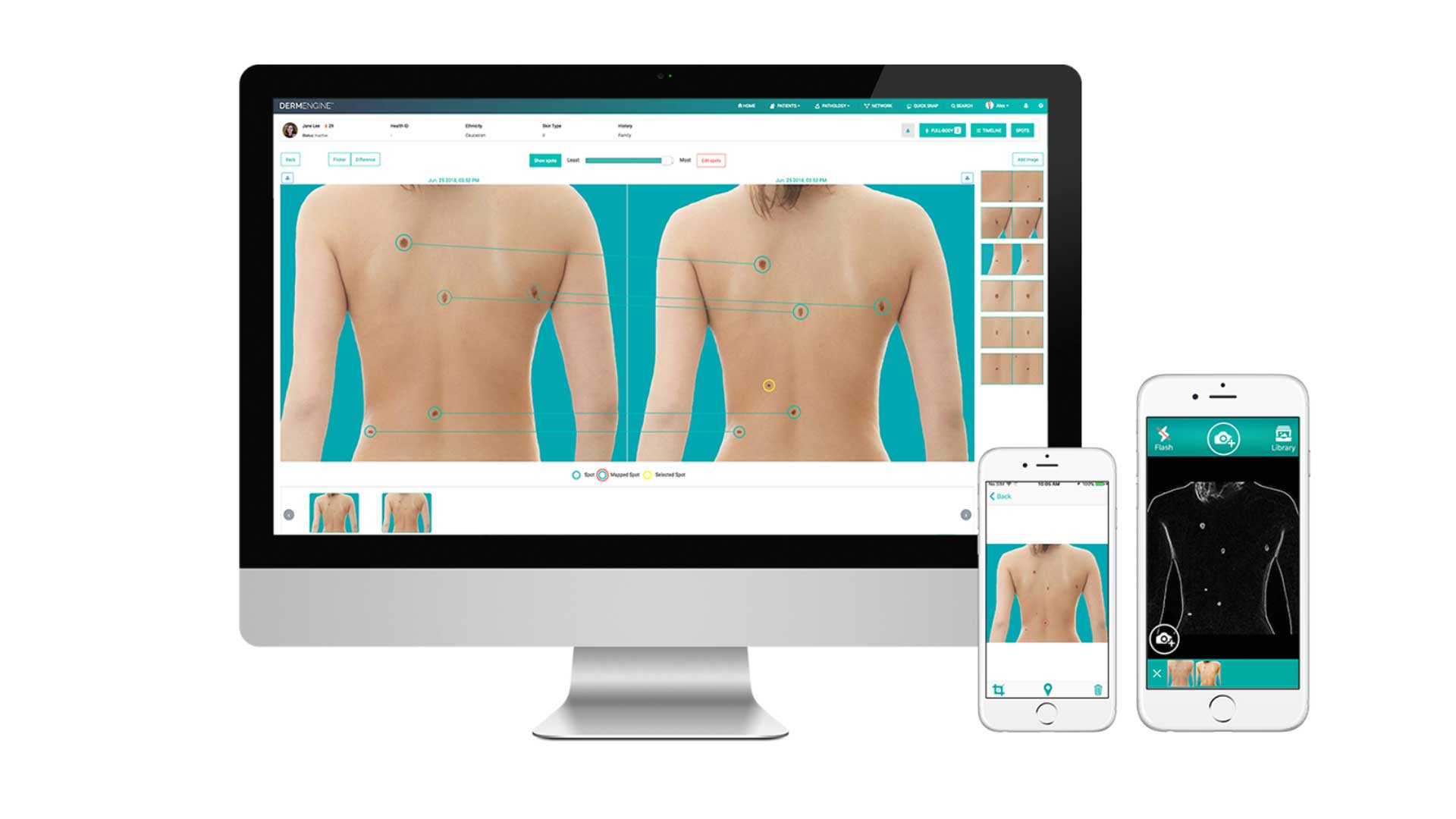 A graphic showing computers and phones with the Dermengine software
